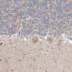 Anti-KIF26B Antibody