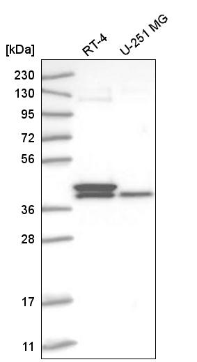 Anti-TFB2M Antibody