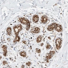 Anti-DIRAS3 Antibody