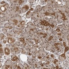 Anti-EXOSC10 Antibody