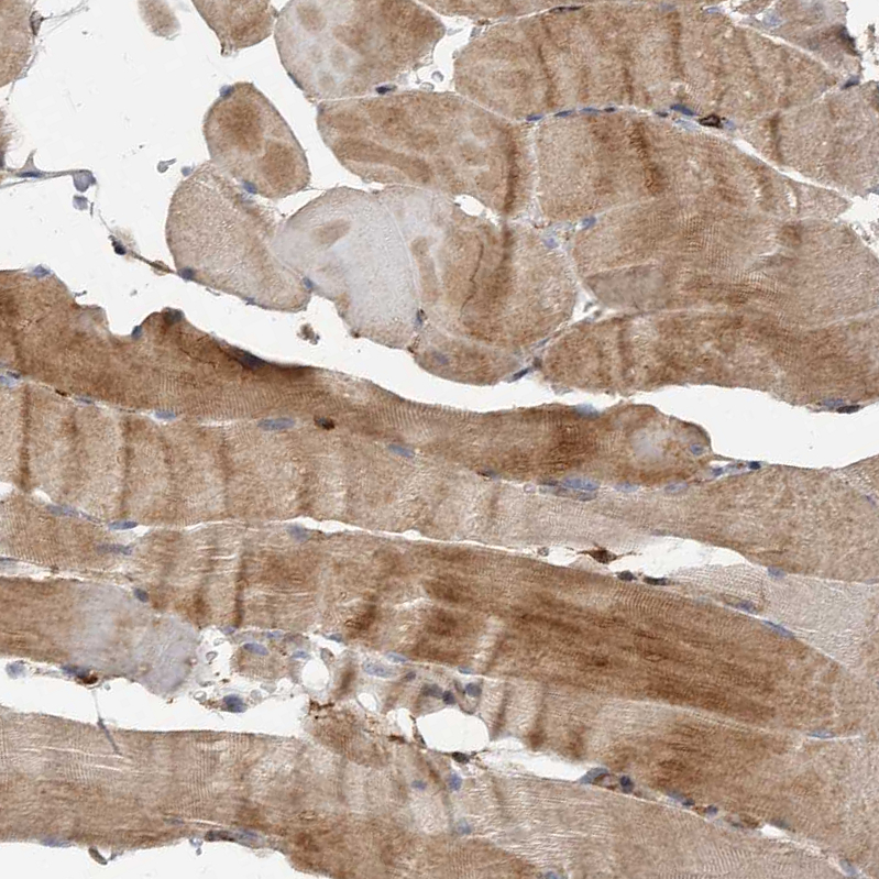 Anti-FLAD1 Antibody