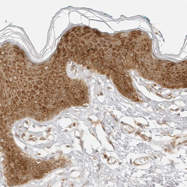 Anti-EIF4G1 Antibody