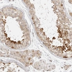 Immunohistochemical staining of human testis shows moderate to strong cytoplasmic positivity in spermatids.