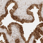 Immunohistochemical staining of human prostate shows moderate to strong cytoplasmic positivity in glandular cells.