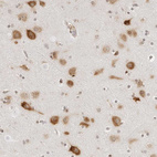 Immunohistochemical staining of human cerebral cortex shows moderate cytoplasmic positivity in neurons.
