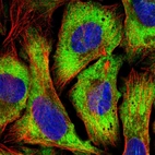 Immunofluorescent staining of human cell line U-2 OS shows localization to cytosol.
