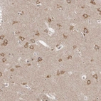 Anti-NENF Antibody