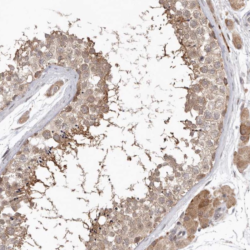 Anti-NSUN4 Antibody