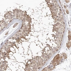 Anti-NSUN4 Antibody