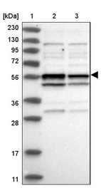 Lane 1: Marker [kDa] 230, 130, 95, 72, 56, 36, 28, 17, 11_br/_Lane 2: Human cell line RT-4_br/_Lane 3: Human cell line U-251MG sp