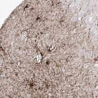 Anti-C1orf74 Antibody