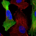 Immunofluorescent staining of human cell line U-251 MG shows localization to plasma membrane & cytosol.