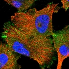 Immunofluorescent staining of human cell line U-251 MG shows localization to plasma membrane & focal adhesion sites.