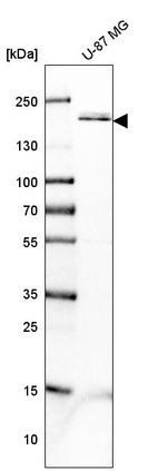 Anti-PDGFRB Antibody