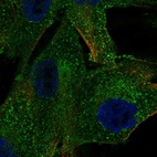 Immunofluorescent staining of human cell line ASC TERT1 shows localization to the Golgi apparatus & vesicles.