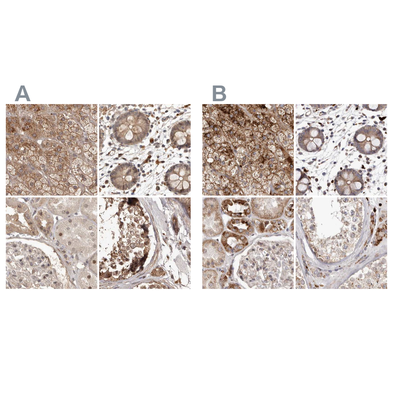 Anti-NUP43 Antibody