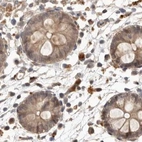 Immunohistochemical staining of human colon using Anti-NUP43 antibody HPA028500.