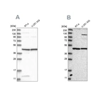 Western blot analysis using Anti-NUP43 antibody HPA028500 (A) shows similar pattern to independent antibody HPA027126 (B).