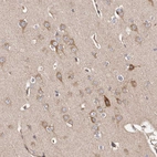 Immunohistochemical staining of human Cerebral cortex shows moderate cytoplasmic positivity in neuronal cells.