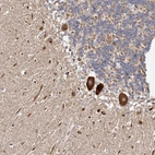 Immunohistochemical staining of human Cerebellum shows strong cytoplasmic positivity in Purkinje cells.