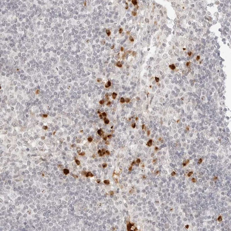 Anti-ZNF678 Antibody