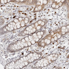 Immunohistochemical staining of human rectum shows strong cytoplasmic positivity in subset of lymphoid cells.