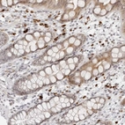 Immunohistochemical staining of human rectum shows strong cytoplasmic positivity in subset of lymphoid cells.