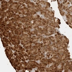 Immunohistochemical staining of human pancreas shows strong granular cytoplasmic positivity in exocrine glandular cells.