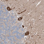 Anti-RUSC1 Antibody