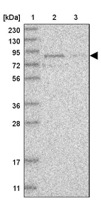 Lane 1: Marker [kDa] 230, 130, 95, 72, 56, 36, 28, 17, 11_br/_Lane 2: Human cell line RT-4_br/_Lane 3: Human cell line U-251MG sp