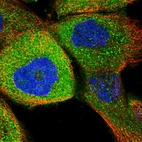 Immunofluorescent staining of human cell line A-431 shows localization to cytosol.