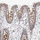 Immunohistochemical staining of human colon shows moderate cytoplasmic positivity in glandular cells.