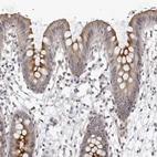 Immunohistochemical staining of human colon shows moderate cytoplasmic positivity in glandular cells.