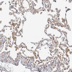 Immunohistochemical staining of human lung shows moderate cytoplasmic positivity in macrophages.