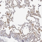 Immunohistochemical staining of human lung shows moderate cytoplasmic positivity in macrophages.