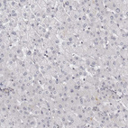 Immunohistochemical staining of human liver shows no positivity in hepatocytes as expected.