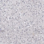 Immunohistochemical staining of human liver shows no positivity in hepatocytes as expected.