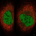 Immunofluorescent staining of human cell line A-431 shows localization to nucleoplasm.