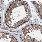 Immunohistochemical staining of human testis shows strong cytoplasmic positivity in cells in seminiferous ducts.