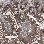 Immunohistochemical staining of human small intestine shows moderate cytoplasmic positivity in glandular cells.