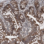 Immunohistochemical staining of human small intestine shows moderate cytoplasmic positivity in glandular cells.