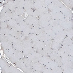 Immunohistochemical staining of human skeletal muscle shows no cytoplasmic positivity in myocytes as expected.