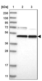 Lane 1: Marker [kDa] 230, 130, 95, 72, 56, 36, 28, 17, 11_br/_Lane 2: Human cell line RT-4_br/_Lane 3: Human cell line U-251MG sp
