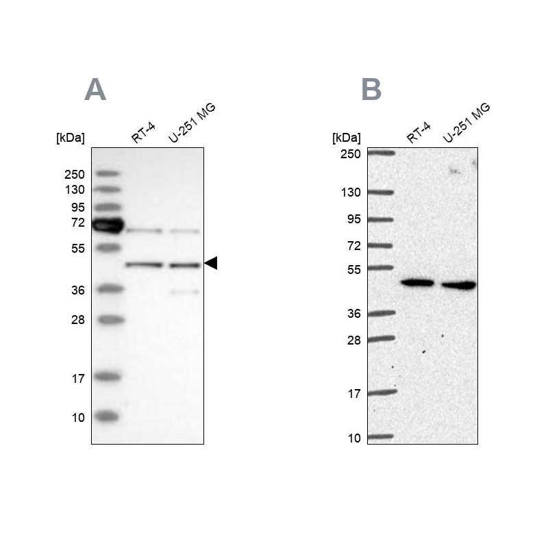 Anti-SLC25A24 Antibody