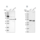 Anti-SLC25A24 Antibody