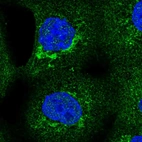 Immunofluorescent staining of human cell line A-431 shows localization to mitochondria.