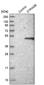 Western blot analysis in control (vector only transfected HEK293T lysate) and STRADB over-expression lysate (Co-expressed with a C-terminal myc-DDK tag (~3.1 kDa) in mammalian HEK293T cells, LY402696).