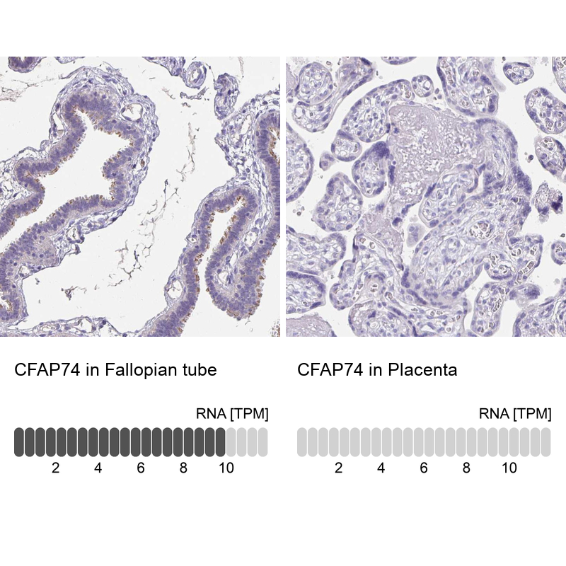 Anti-CFAP74 Antibody