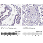 Anti-CFAP74 Antibody