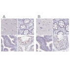 Immunohistochemical staining of human cerebral cortex, colon, fallopian tube and testis using Anti-CFAP74 antibody HPA028521 (A) shows similar protein distribution across tissues to independent antibody HPA029274 (B).